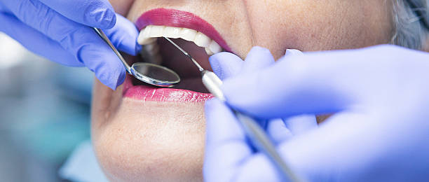Best Emergency Denture Repair in Plymouth, NC