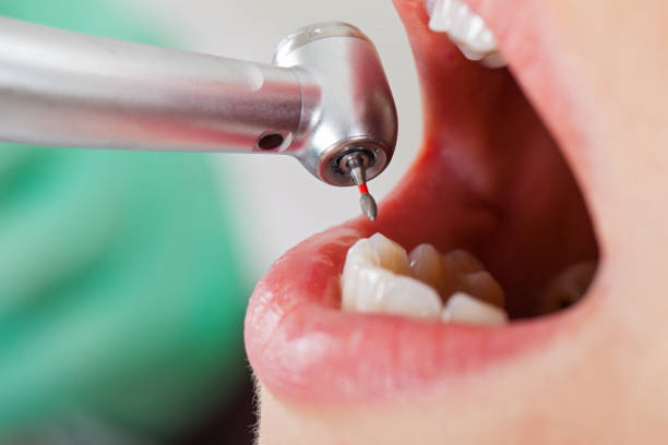 Best Emergency Denture Repair in Plymouth, NC
